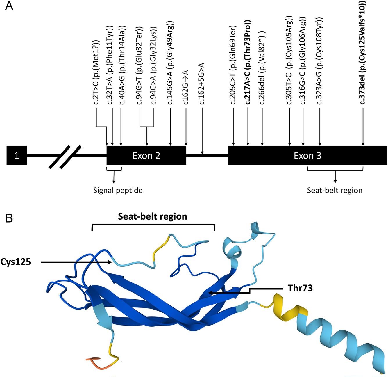 【佳学基因检测】基因解码基因检测鉴别新型 TSHB 变异 (c.217A>C) 导致中枢性甲状腺功能减退和垂体增生